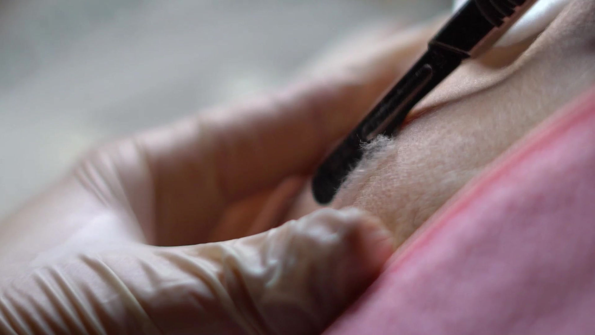 Services Video: Skintastic